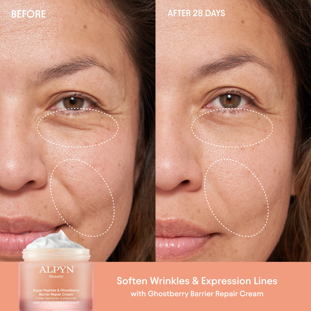 Alpyn Beauty-Super Peptide & Ghostberry Barrier Repair Cream-