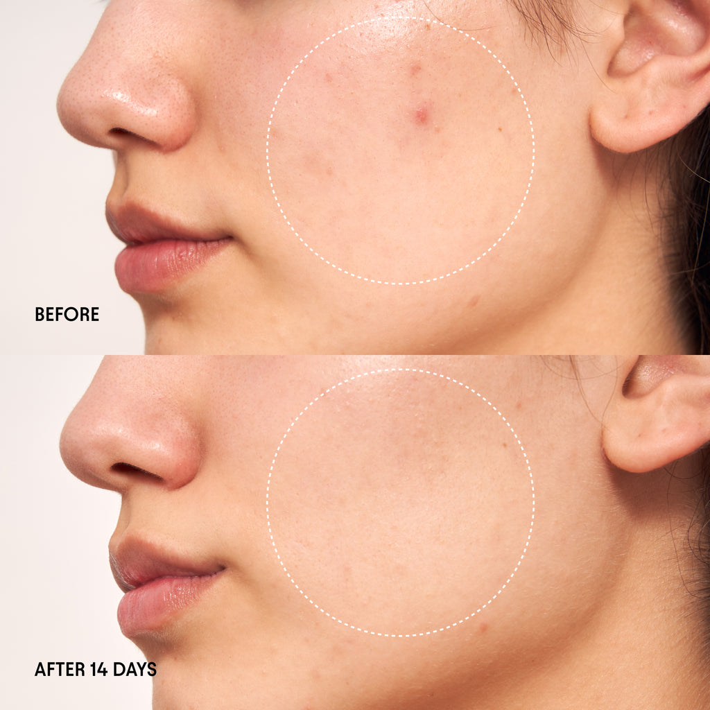 Alpyn Beauty-Wild Huckleberry Radiance Recovery Peel-